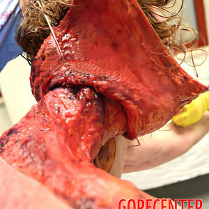 Skinned-woman-on-autopsy-table-7.jpg