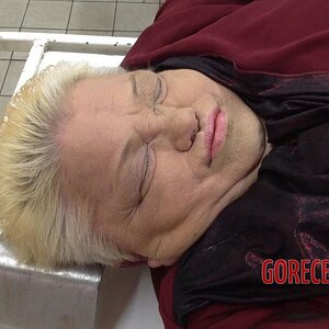 Morbidly-obese-woman-in-morgue-6.jpg