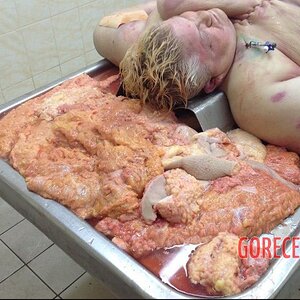 Morbidly-obese-woman-in-morgue-5.jpg