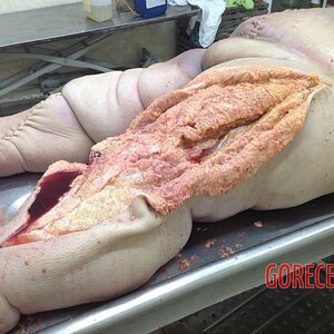 Morbidly-obese-woman-in-morgue-4.jpg