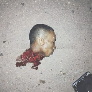 xgore-Brazilian-man-was-beheaded-by-accident-ui564ter-2-1024x1024.jpg