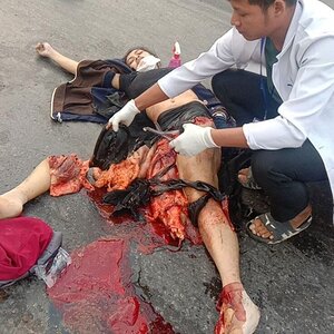 Young-Cambodian-woman-crushed-by-truck-6.jpg