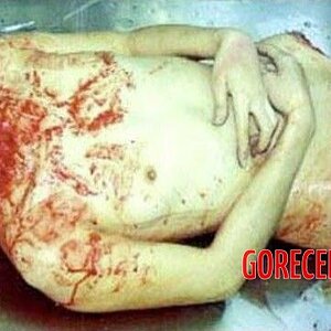 Dismembered-Asian-woman-in-morgue-2.jpg