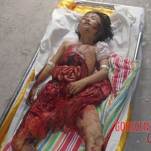 Chinese-7-year-old-village-girl-died-in-car-accident-2.jpg