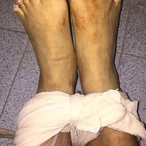 dead-bound-man-w-flayed-face-had-fingers-toes-cut-off-dumped-w-msg-6-Juana-Moza-MX-sep-12-18.jpg