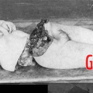 MIX-Old-photos-of-dismembered-women-2-1.jpg