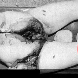 MIX-Old-photos-of-dismembered-women-2-5.jpg