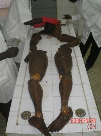 African-woman-dismembered-into-pieces-4.jpg