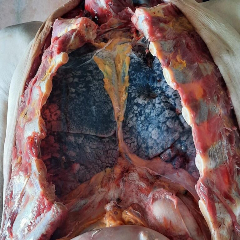 Autopsy-photo-of-smoker-lungs-768x767.jpg