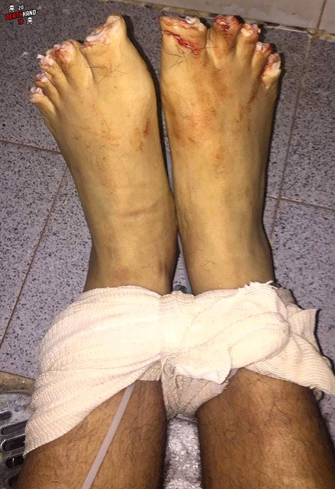 dead-bound-man-w-flayed-face-had-fingers-toes-cut-off-dumped-w-msg-6-Juana-Moza-MX-sep-12-18.jpg