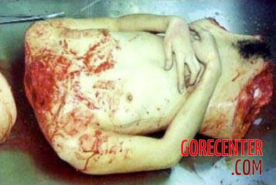 Dismembered-Asian-woman-in-morgue-2.jpg