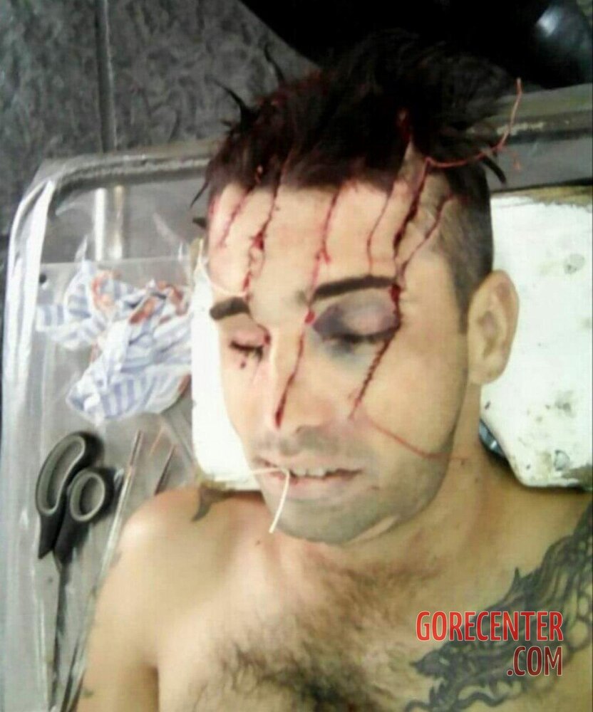 Dude-dies-with-his-head-destroyed-after-machete-attack-7.jpg