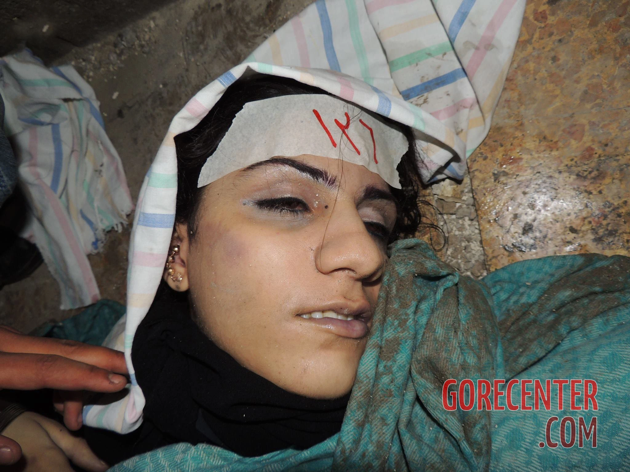 female-victims-of-chemical-attack-4-3063842244.webp