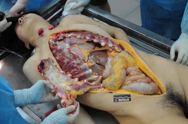 MIX-Autopsies-of-women-1.webp