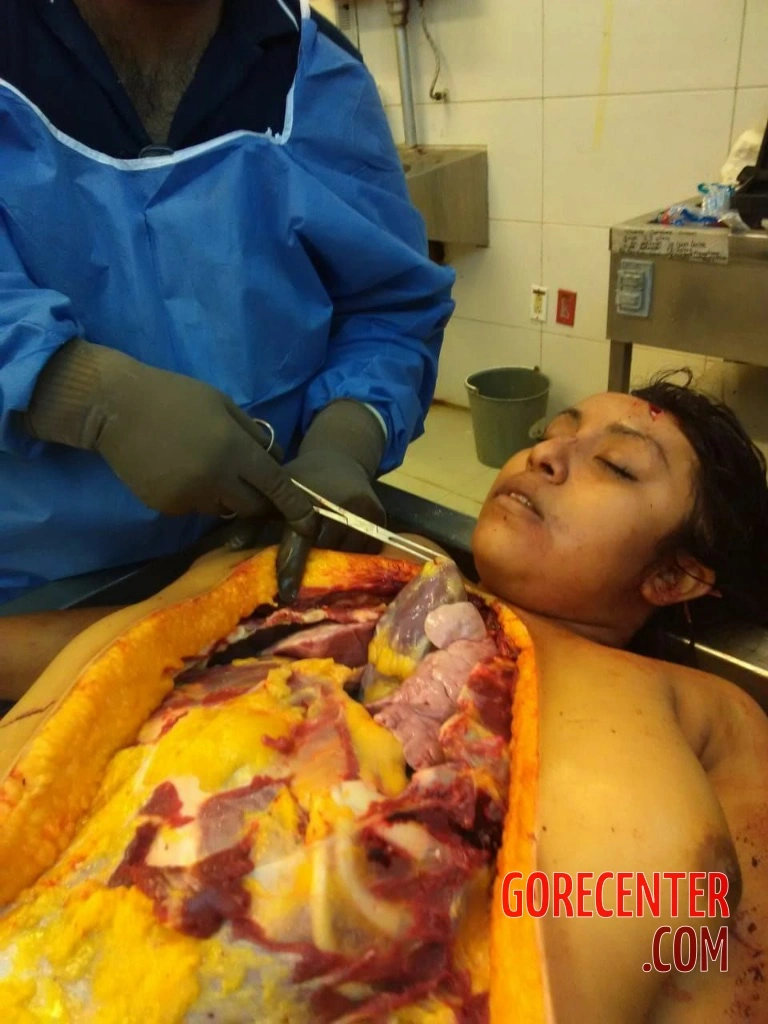 MIX-Autopsies-of-women-3.webp