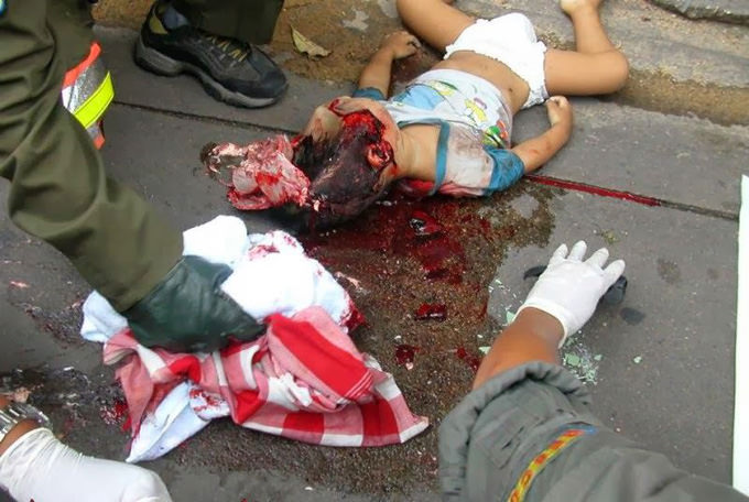 very-graphic-pictures-of-2-Year-old-toddler-02.jpg