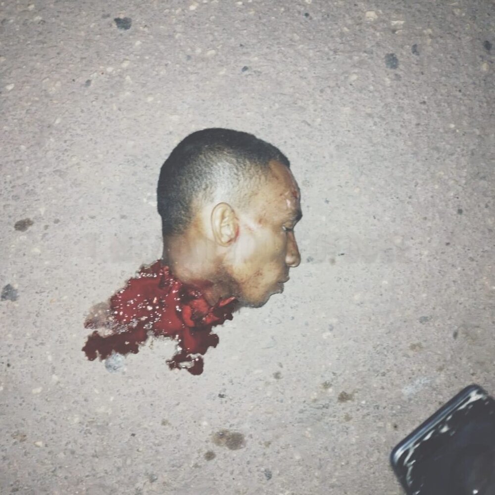 xgore-Brazilian-man-was-beheaded-by-accident-ui564ter-2-1024x1024.jpg