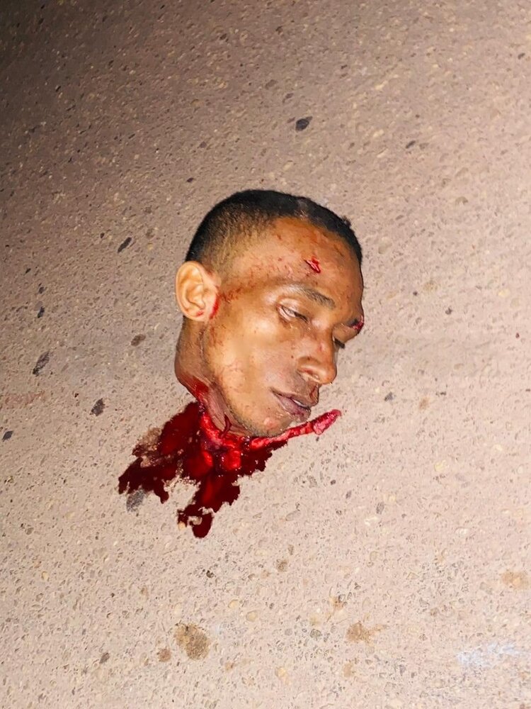 xgore-Brazilian-man-was-beheaded-by-accident-ui564ter-3.jpg